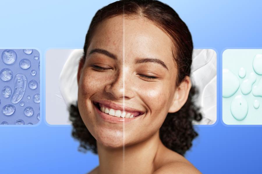A woman smiling with one side of her face without retinol and the other side with. A woman smiling with one side of her face without retinol and the other side with.