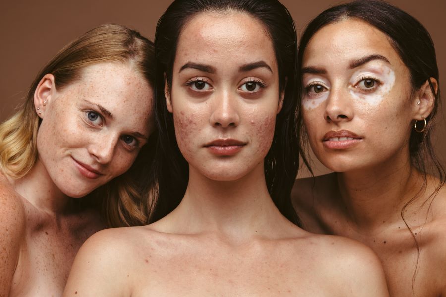 three women different skin types and need for skin care