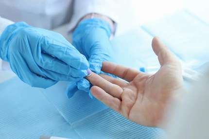 Image Blood prick test