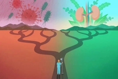 Illustration of patient connected to IV drip walking on a path forked to healthy kidneys and bacteria or virus